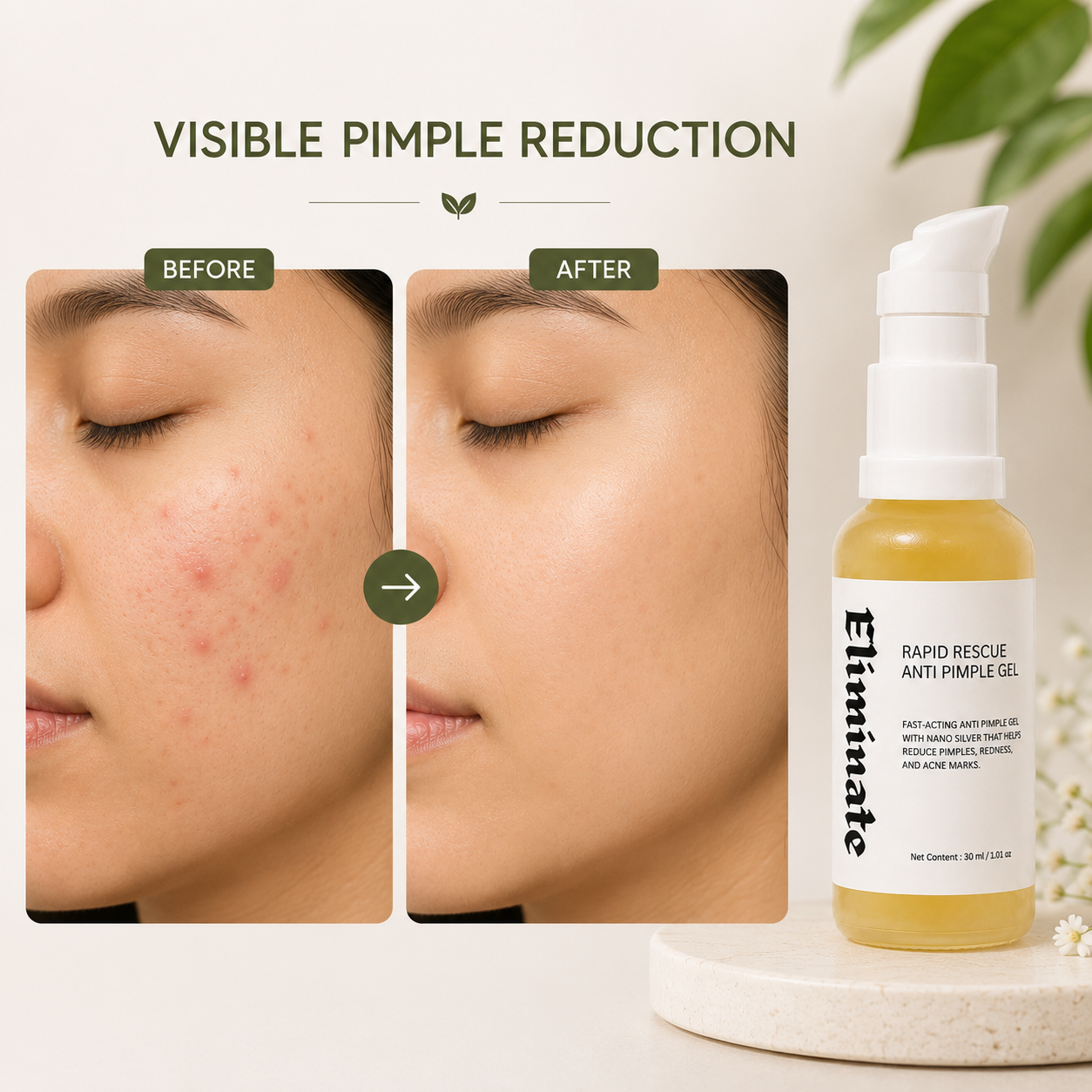 Eliminate – Anti Pimple Gel 3